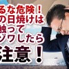 【ハゲ予防】それって頭皮の日焼けかも?髪に触ってゾワゾワしたら要注意!